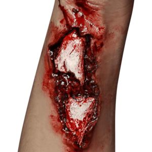 Broken Arm Prosthetic